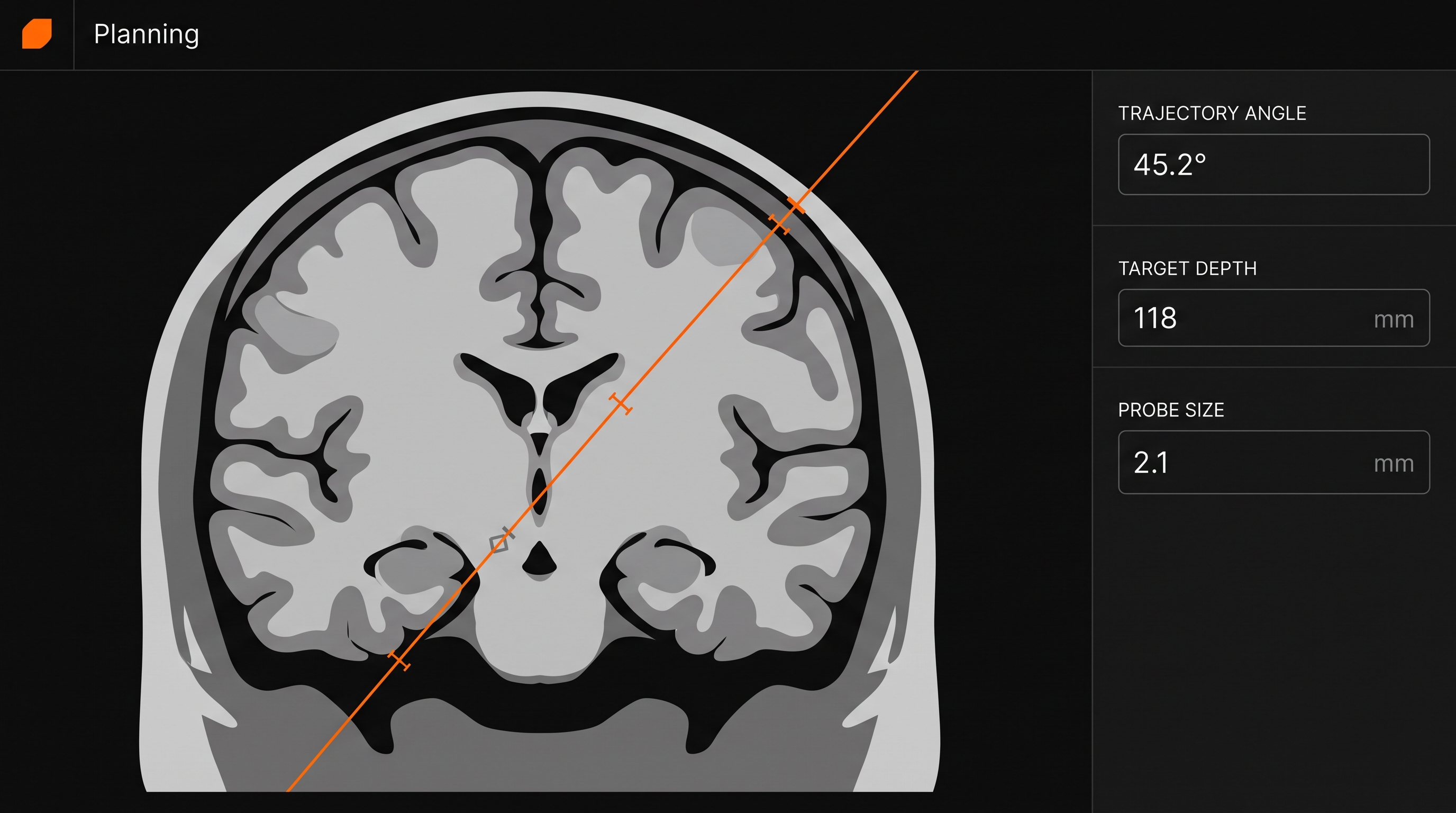 Stereotactic Surgical Planning Software product screenshot